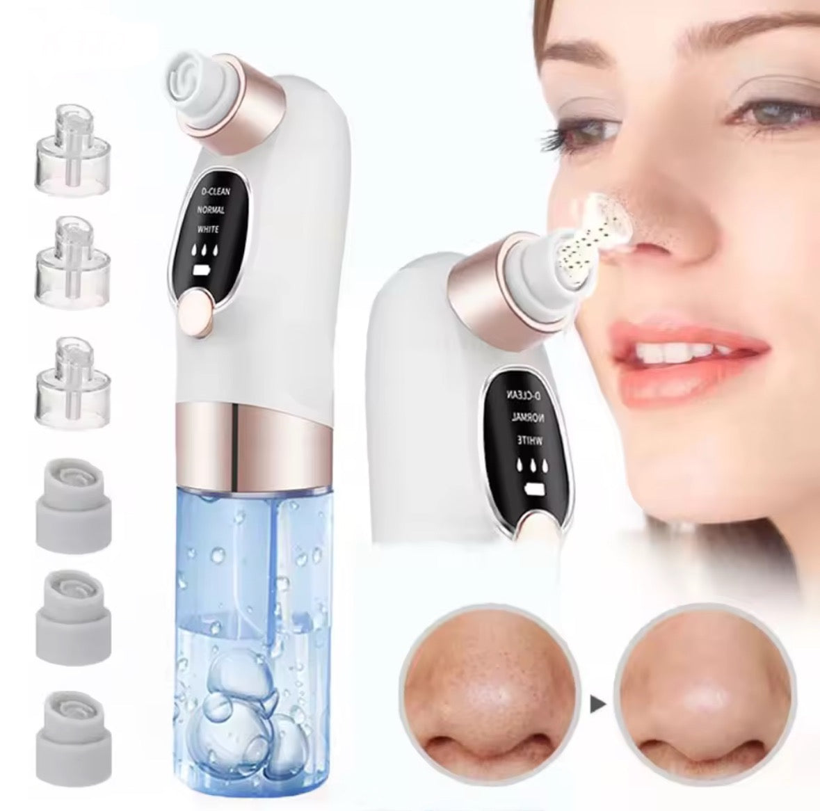Résultats avant/après avec MiniSweep Skin™ – embouts inclus et démonstration d'utilisation